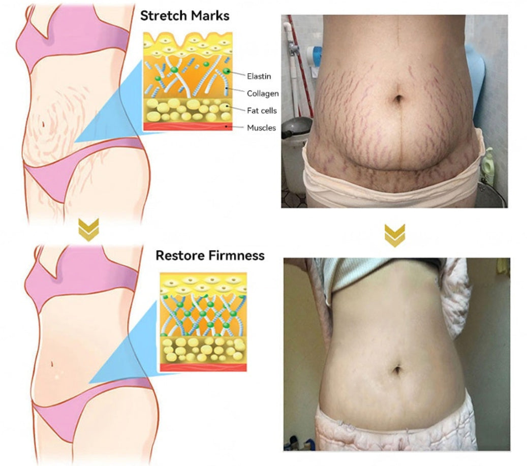 Made and Shipped from USA โจHistoneยฎ ๐ก๐พ๐พ ๐๐พ๐๐๐ ๐ฒ๐๐๐ ๐ฑ๐พ๐๐๐๐๐บ๐๐๐๐ ๐ข๐๐พ๐บ๐