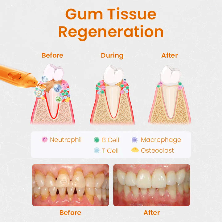 [Official Brand Store] LOVILDS™ Gum Repair Treatment Ampoules