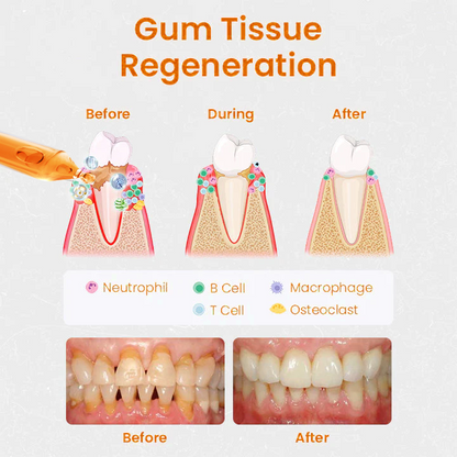 [Official Brand Store] LOVILDS™ Gum Repair Treatment Ampoules
