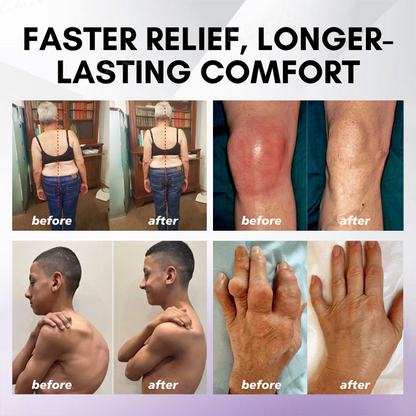 ✅ Official store: LOVILDS™ Turmeric & Emu Oil Arthritis Soothing Pain Relief Massage Gel(👨‍⚕️AAD Recommended)