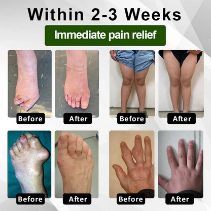 🔥LAST DAY SALE-80% OFF🔥 LOVILDS™ Emu Oil JointRelief Ointment