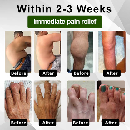 🔥LAST DAY SALE-80% OFF🔥 LOVILDS™ Emu Oil JointRelief Ointment