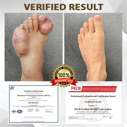 🔥LAST DAY SALE-80% OFF🔥 LOVILDS™ Emu Oil JointRelief Ointment