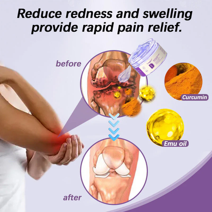 Cougex™ Turmeric & Emu Oil Arthritis Soothing Pain Relief Massage Gel 👨‍⚕️Australian Osteopathic Association （AOA）Approved
