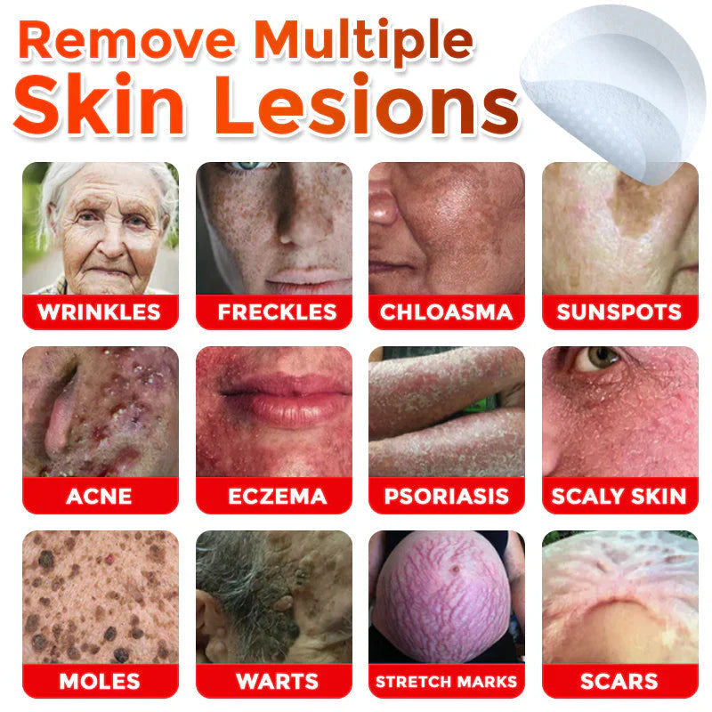 🌿 LOVILDS® MicroNeedle Skin Tag Removal Patch